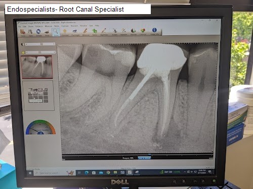Endospecialists- Root Canal Specialist